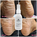 Callus softner spray