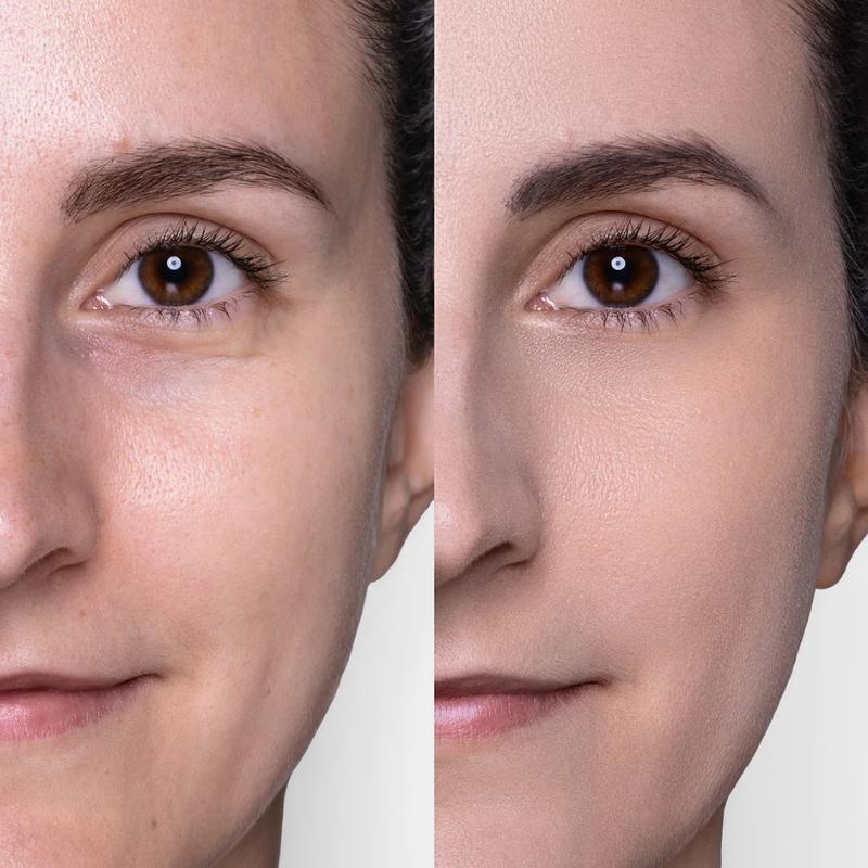 Mat & gentle foundation