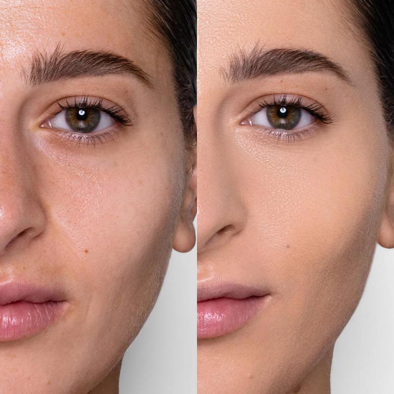 Mat & gentle foundation