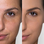 Mat & gentle foundation