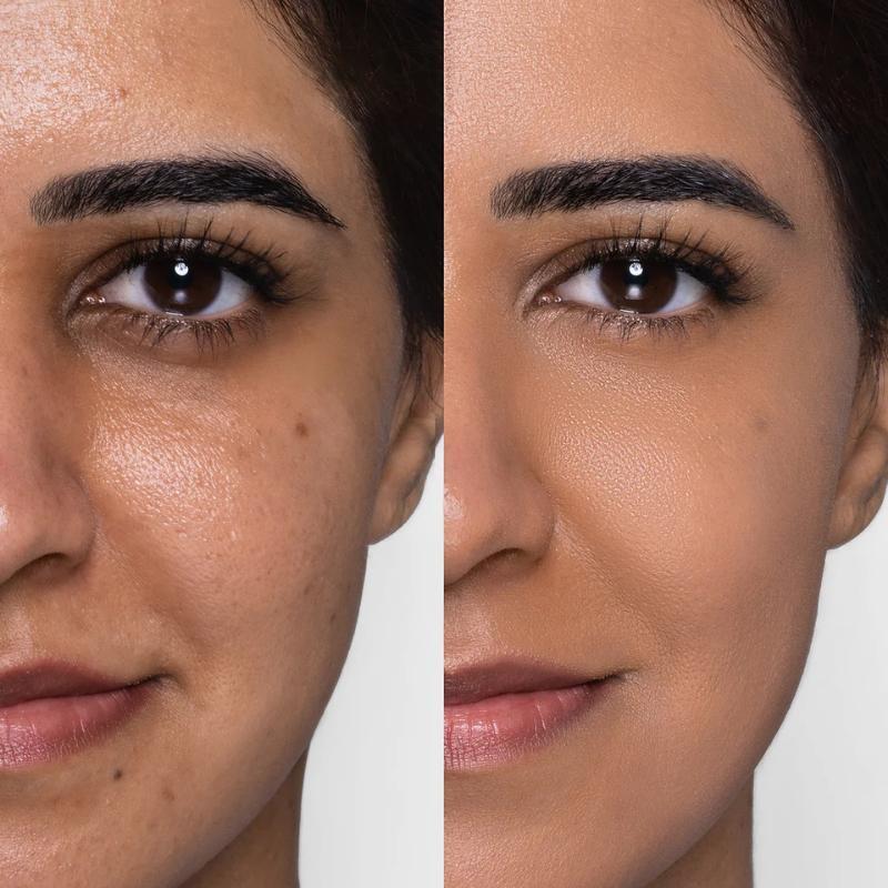 Mat & gentle foundation