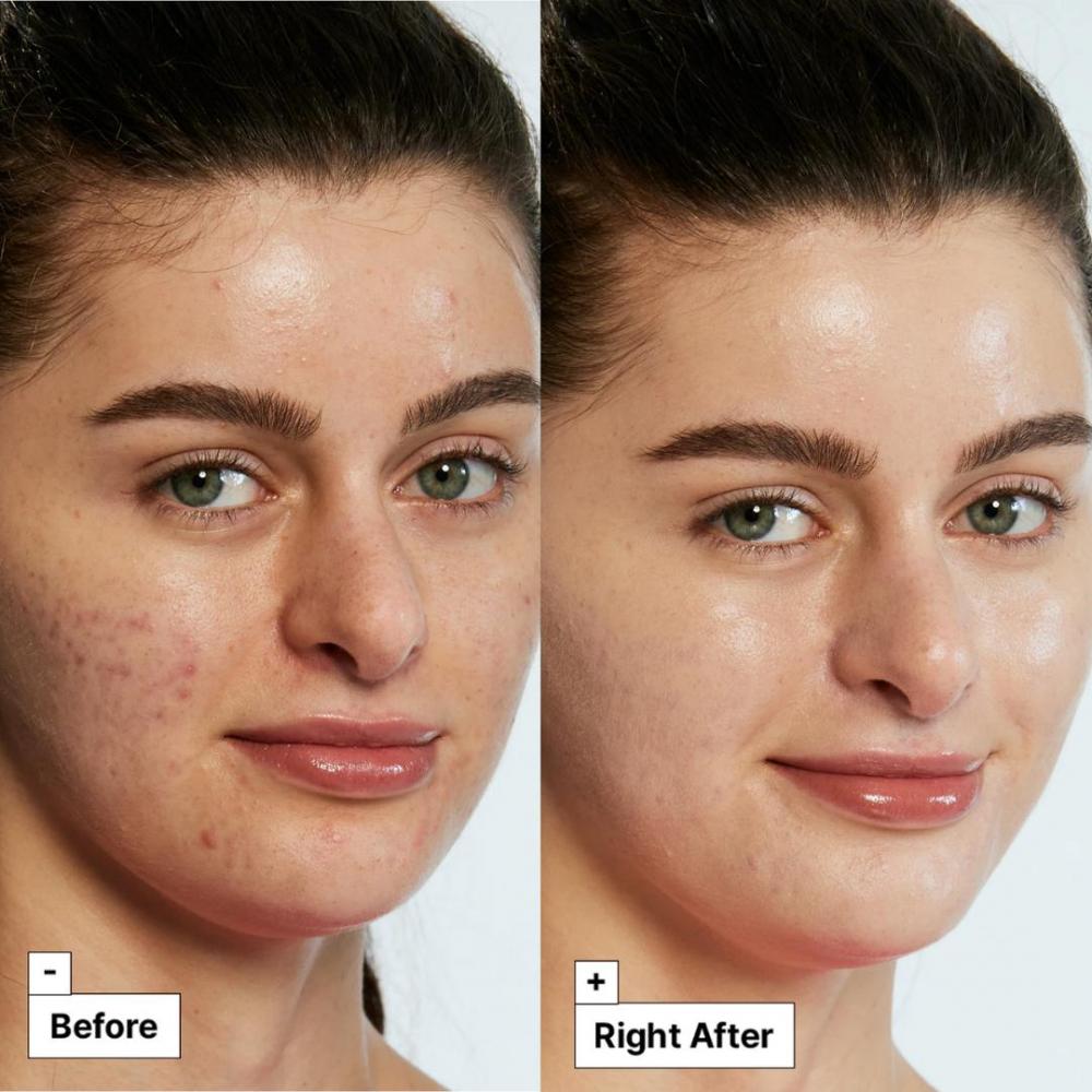 Cicapair™ tiger grass color correcting treatment