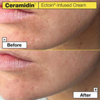 Ceramidin™ ectoin®-infused cream