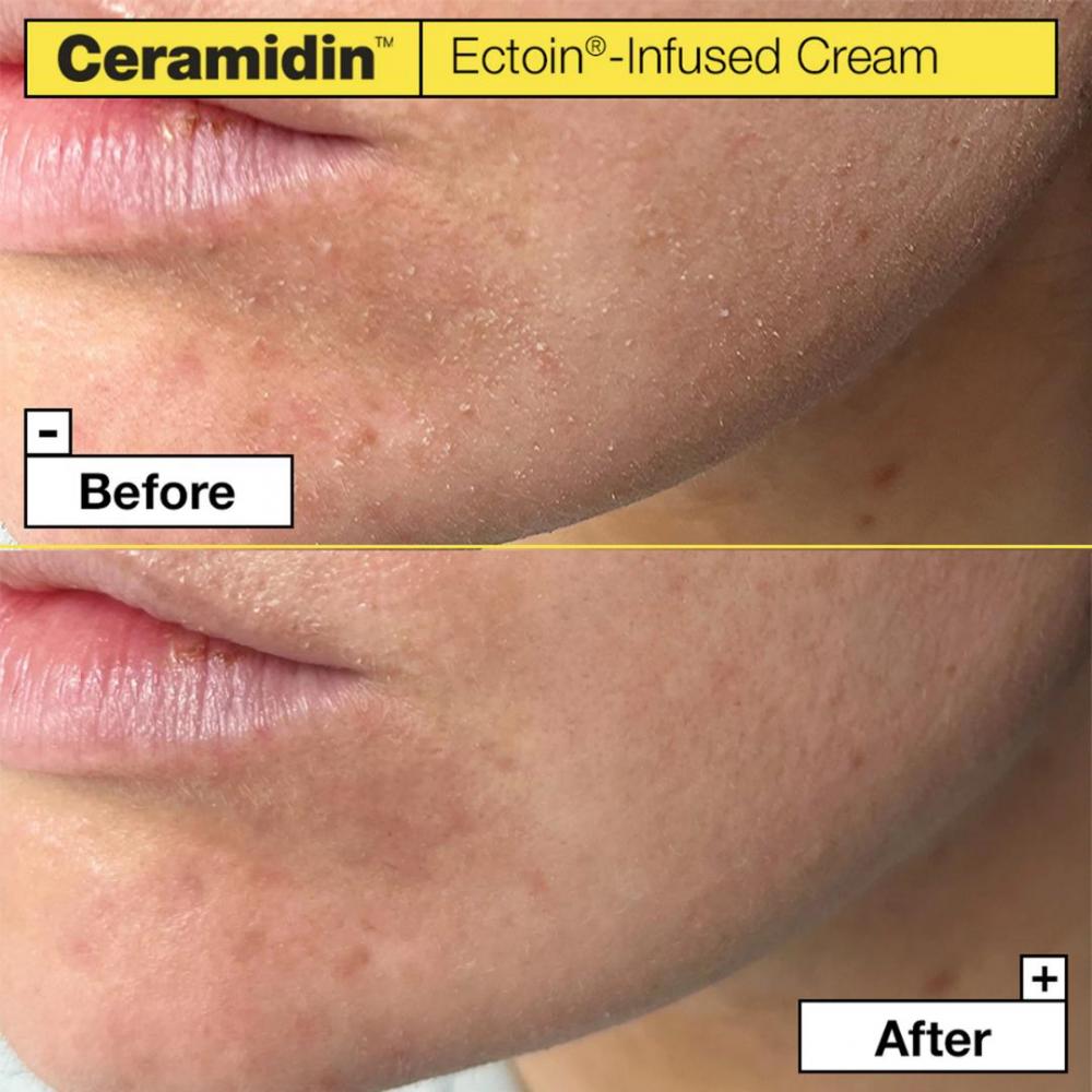 Ceramidin™ ectoin®-infused cream