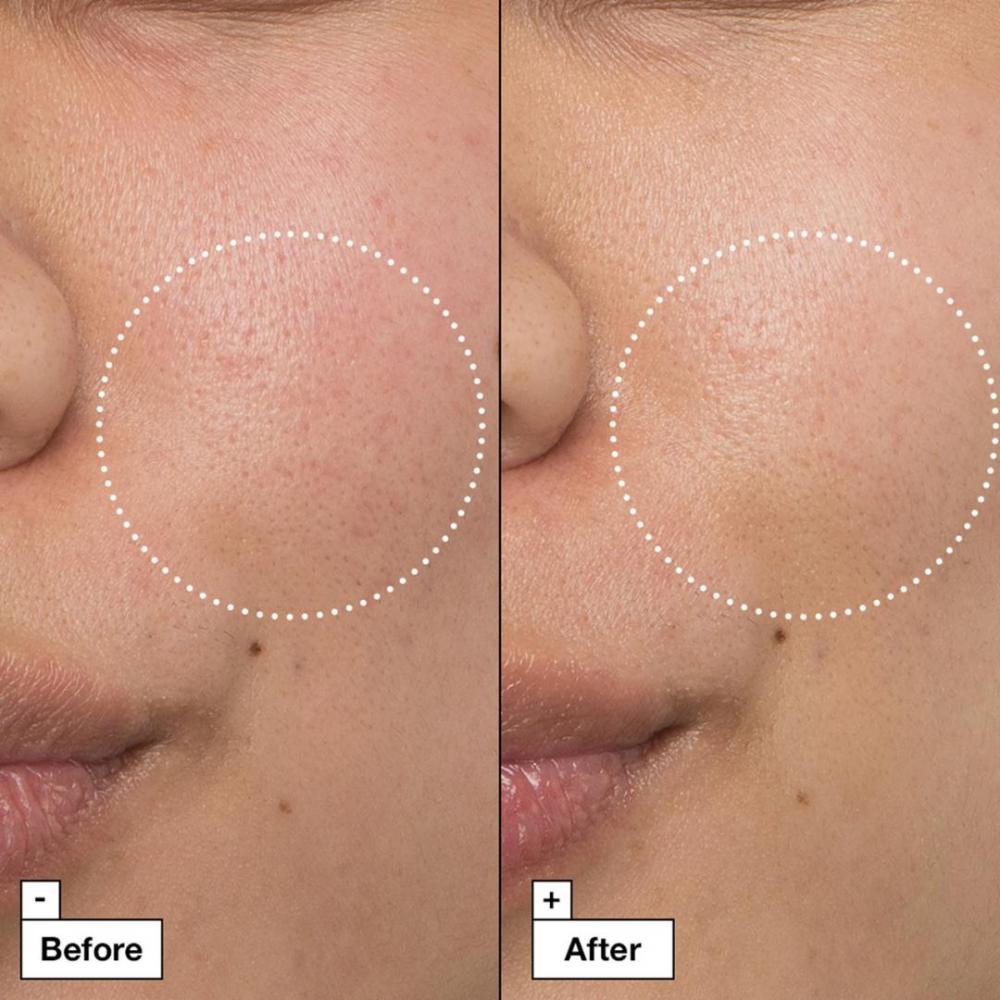 Cicapair™ - crema riparatrice lenitiva intensa