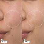 Cicapair™ - crema riparatrice lenitiva intensa
