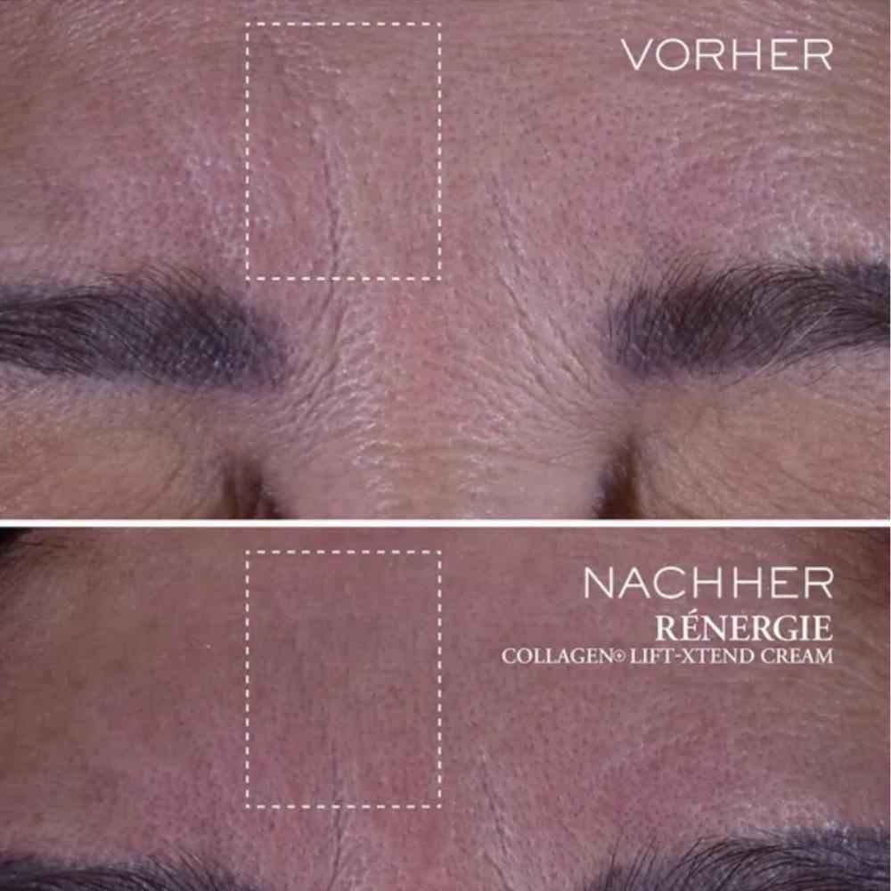 Rénergie collagen lift-xtend cream